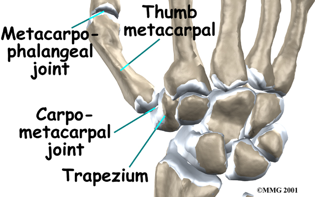 Physical Therapy in Westover for Hand Pain - Arthritis of the Thumb